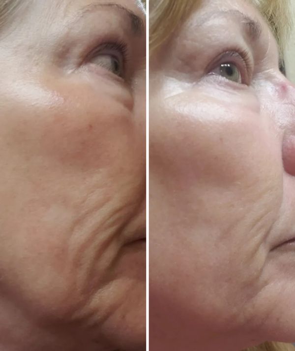 Anti-Aging
