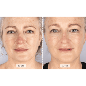CurrentBody Skin Limited Edition LED Beauty Geschenkset