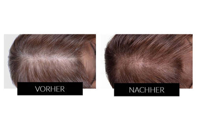 Sichtbare Vorher Nachher Ergebnisse 2