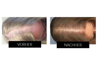 Sichtbare Vorher Nachher Ergebnisse 3