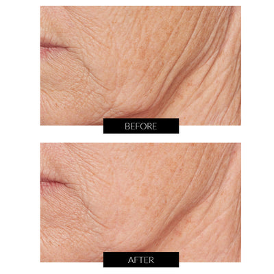 Lancer Skincare Advanced C Radiance Treatment (50ml)