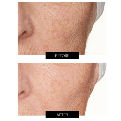 Lancer Skincare The Method: Polish Normal-Combination Skin (120ml)