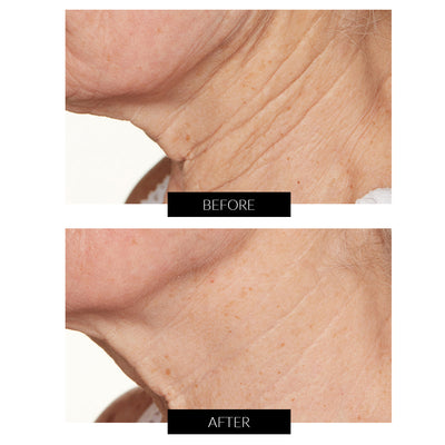 Lancer Skincare Intensive Night Treatment with Hylaplex® and Marula Oil (50ml)