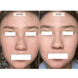 CurrentBody Skin LED 4-in-1 Zonen Mapping Gesichtsmaske in Limitierter Edition