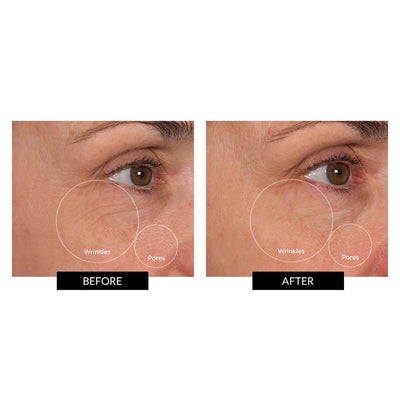 BeautyBio Cryo Duo Aufsatz