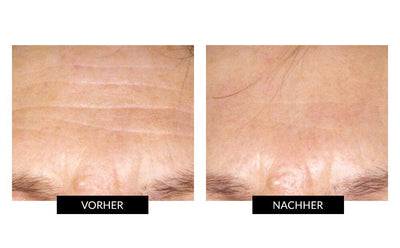 CurrentBody Skin LED Lichttherapie-Maske-CurrentBody Skin-Professionelle Gesichtsreinigung-CurrentBody DE