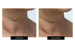 Trophy Skin Mikrodermabrasionsgerät